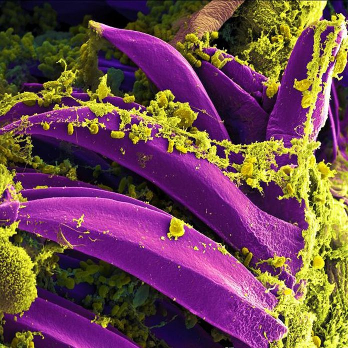 Bacteria under electron microscope