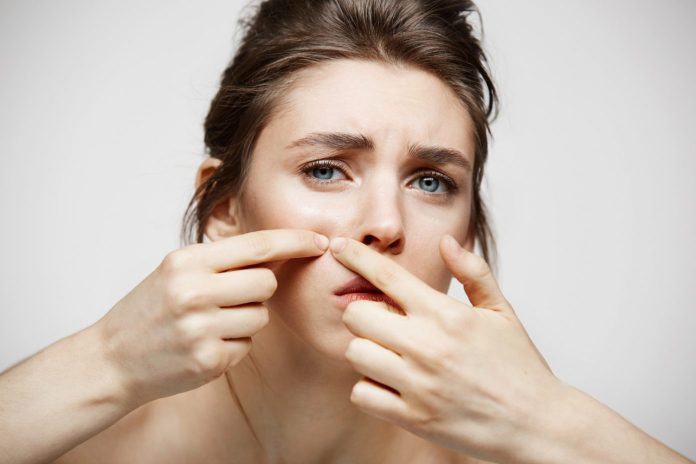 young lady with pimples